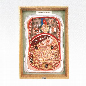 B105 人体寄生虫寄生状態模型 (製造販売企業:株式会社坂本モデル