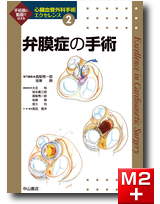 m3電子書籍 | 大動脈疾患の手術 ＜心臓血管外科手術エクセレンス④