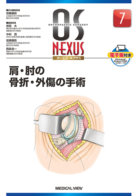 m3電子書籍 | OS NEXUS7 肩・肘の骨折・外傷の手術