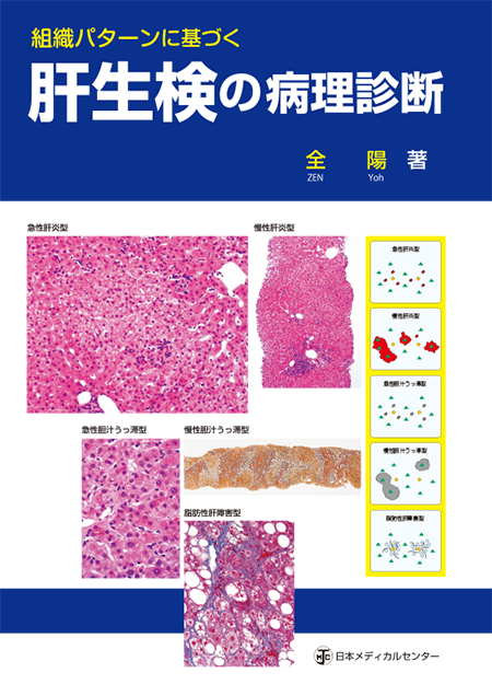 m3電子書籍 | 腫瘍病理鑑別診断アトラス 大腸癌 第2版