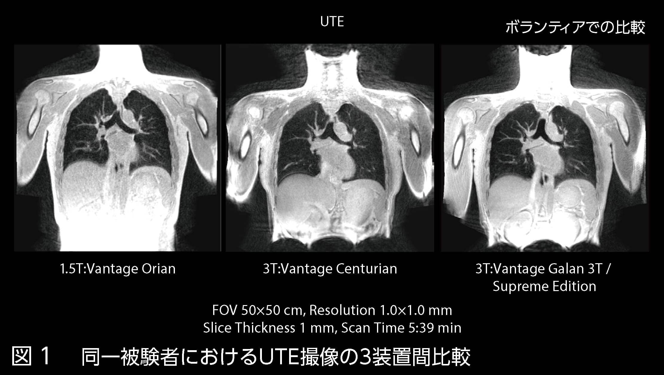 Vantage Galan 3T / Supreme Editionの初期使用経験に基づく将来展望