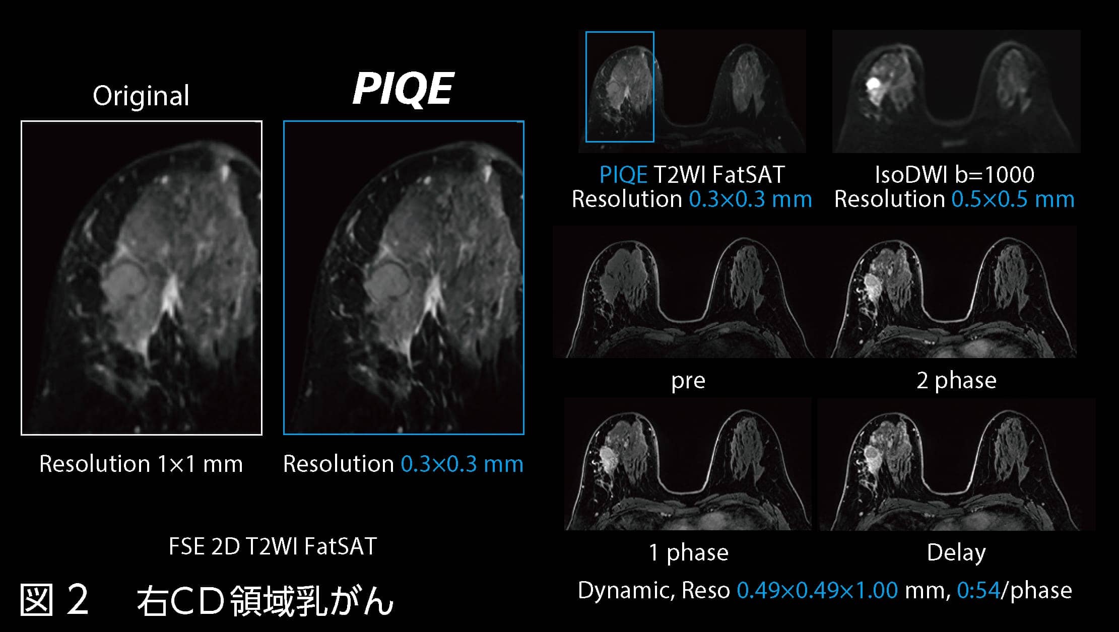 Vantage Galan 3T / Supreme Editionの初期使用経験に基づく将来展望
