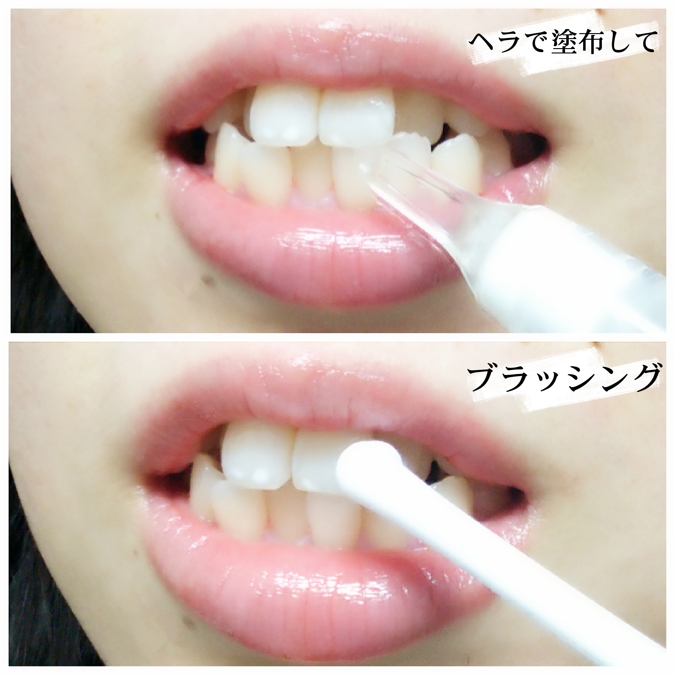 シャイニープラス / 薬用プレミアムホワイトの公式商品情報｜美容