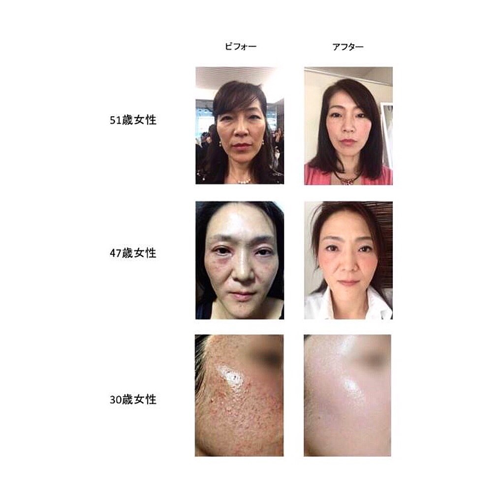 ルビーセル / インテンシブ4Uアンプルの口コミ（by alice-mさん 購入