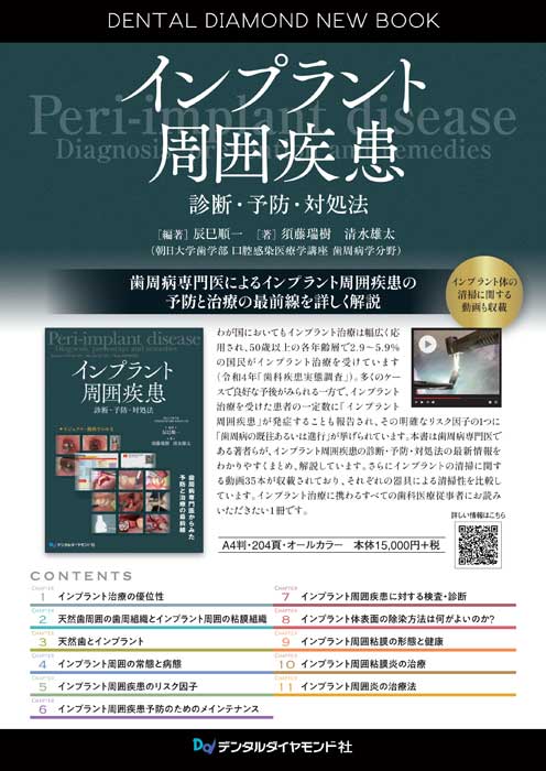 書籍詳細「続・このインプラントなに？」 | フォルディネット