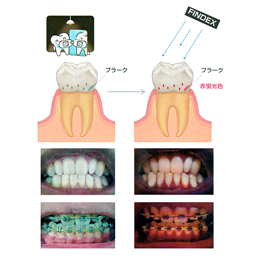 製品詳細「ファインデックス」 | フォルディネット