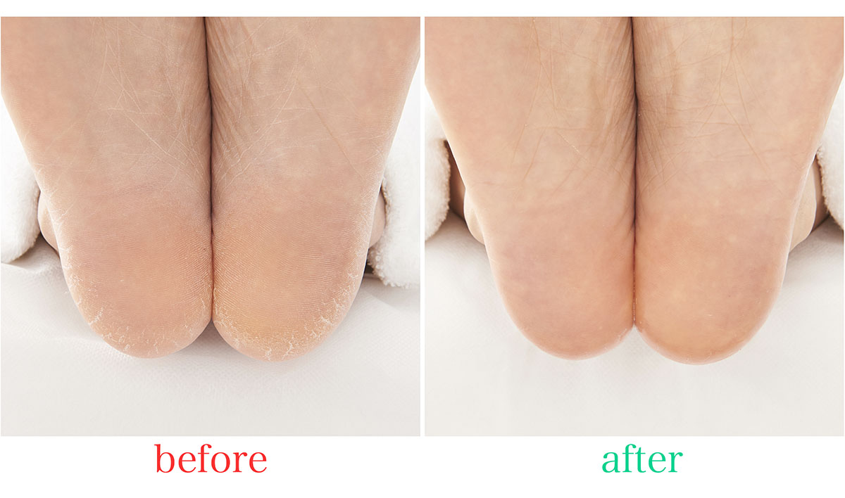 フットケアローション - SpaLuce（スパルーチェ）公式サイト