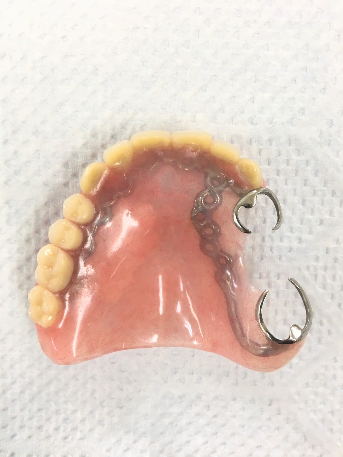 壊れにくいデンチャー製作 | G-REX（ジーレックス）｜新潟にある義歯を