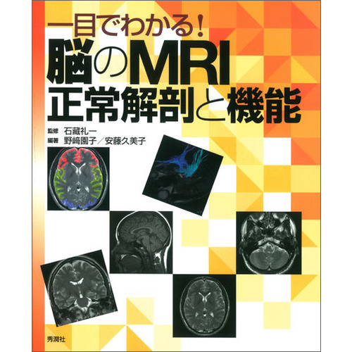 一目でわかる！脳のMRI正常解剖と機能|石藏礼一(監修) 野﨑園子(編