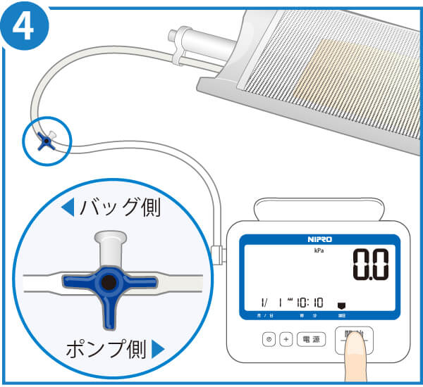 在庫限り】ニプロ EN加圧バッグCS（加圧ポンプ専用）｜ 医療用品通販