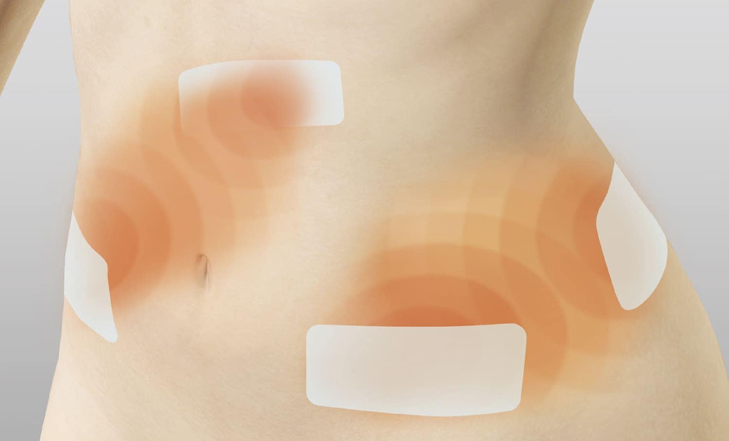 伊藤超短波- エステ化粧品の卸・通販仕入れは【美ガーデン】