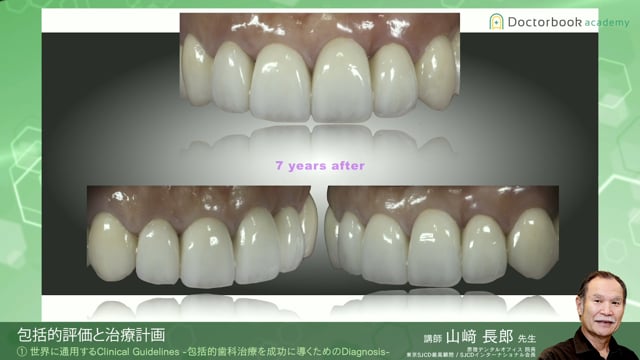 世界に通用する補綴治療の実践 ～機能と美を融合させた歯科治療～ 第1