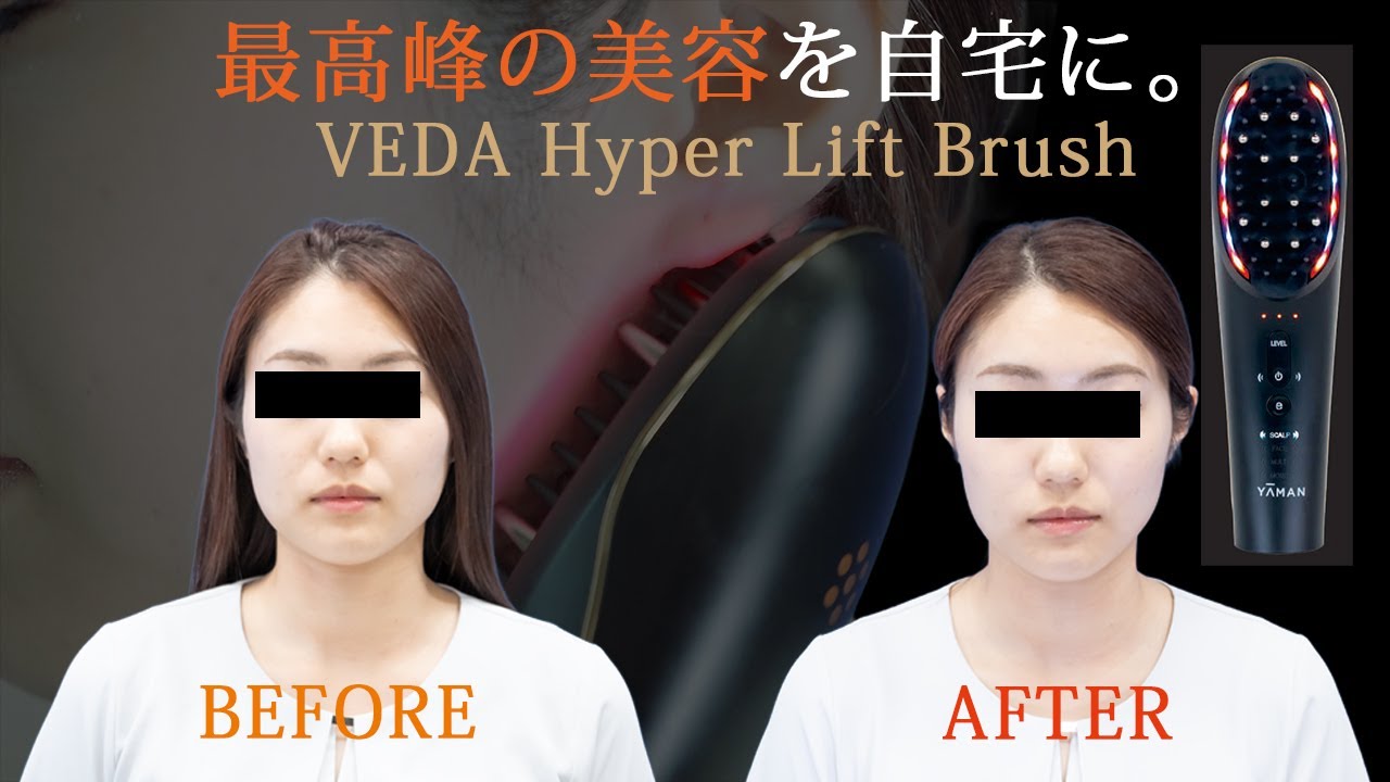 YAMA様へ きれいになりたい! VLVEE美容機器の 美顔器 Vlvee Ve512 超