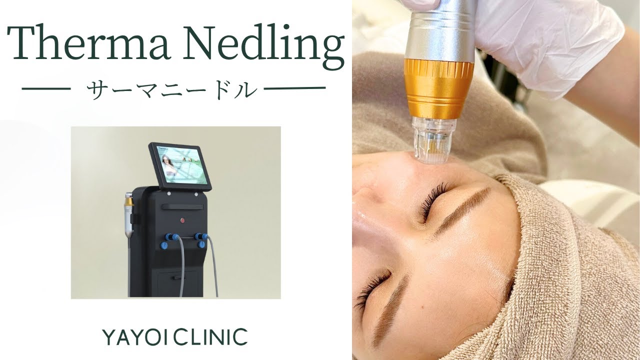 サーマニードル｜広島 ヤヨイクリニック（YAYOI CLINIC）美容皮膚科