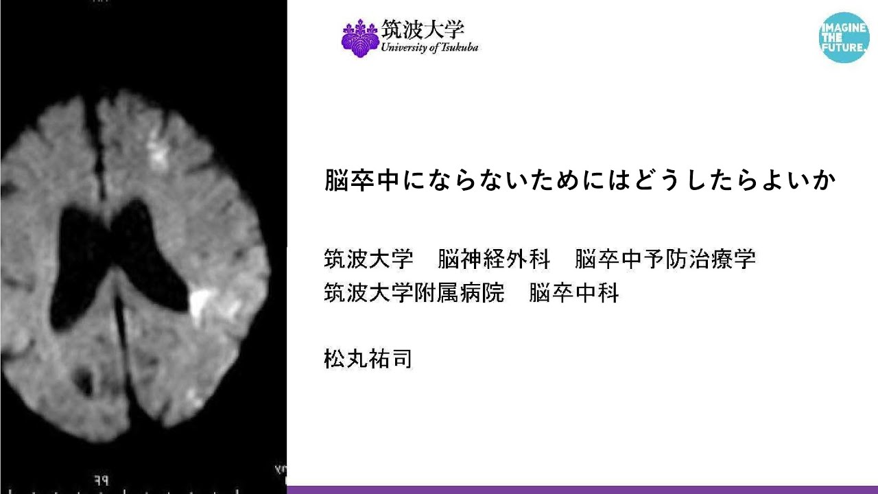 令和5年度公開講座①】脳卒中にならないためにはどうしたらよいか
