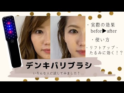 デンキバリブラシ】使い方・効果検証/リフトアップ/美肌/育毛/アンチ