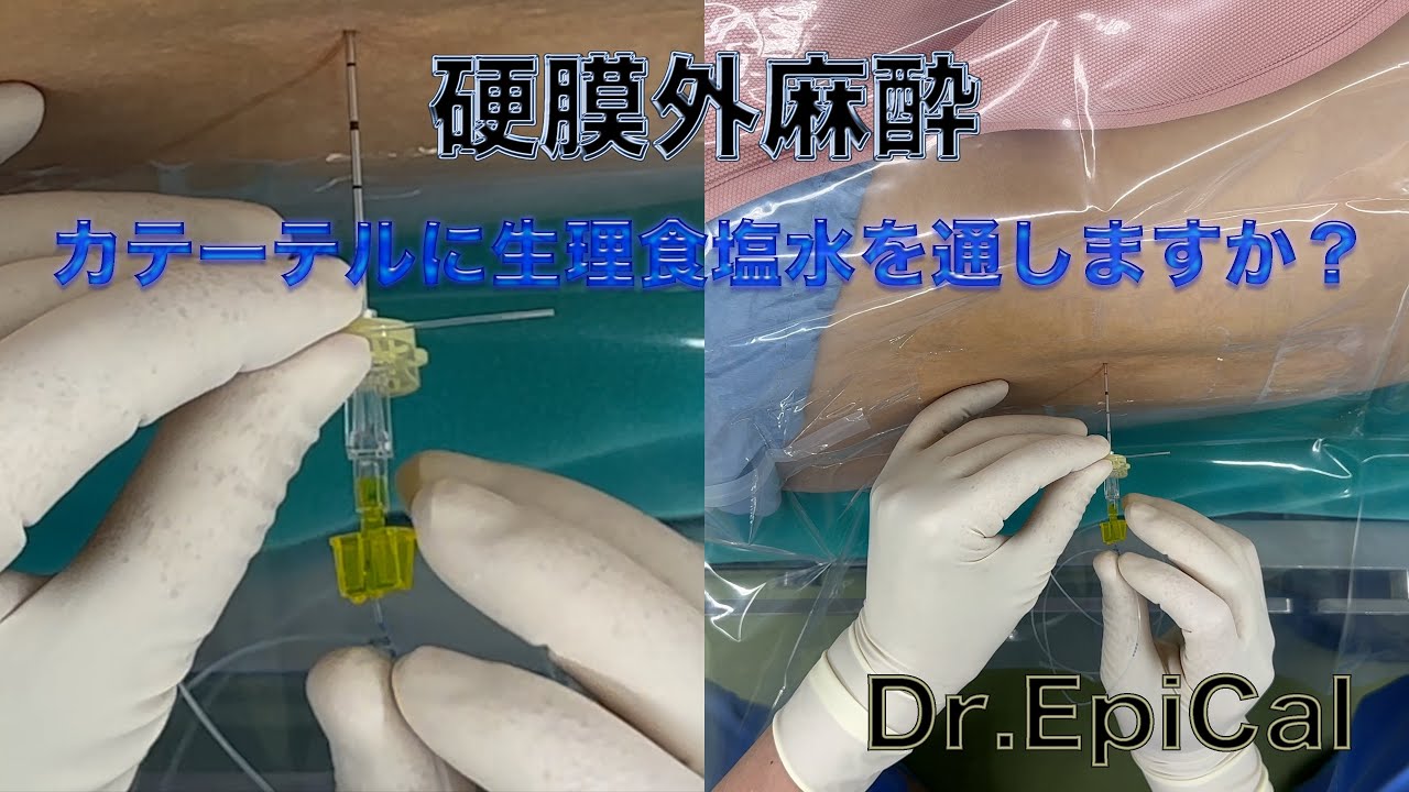硬膜外麻酔 カテーテルに生食を通しますか？epidural anesthesia by Dr
