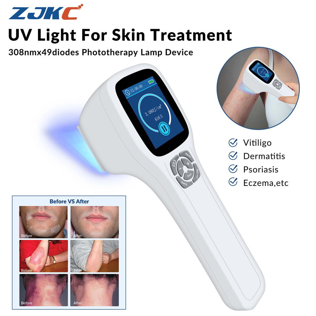 308nm Excimer Uvb Light Therapy Home Use Phototherapy Device for
