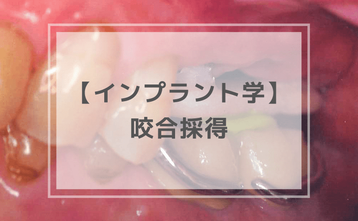 口腔インプラント学：咬合採得（計1問）【歯科医師国家試験】（2025年