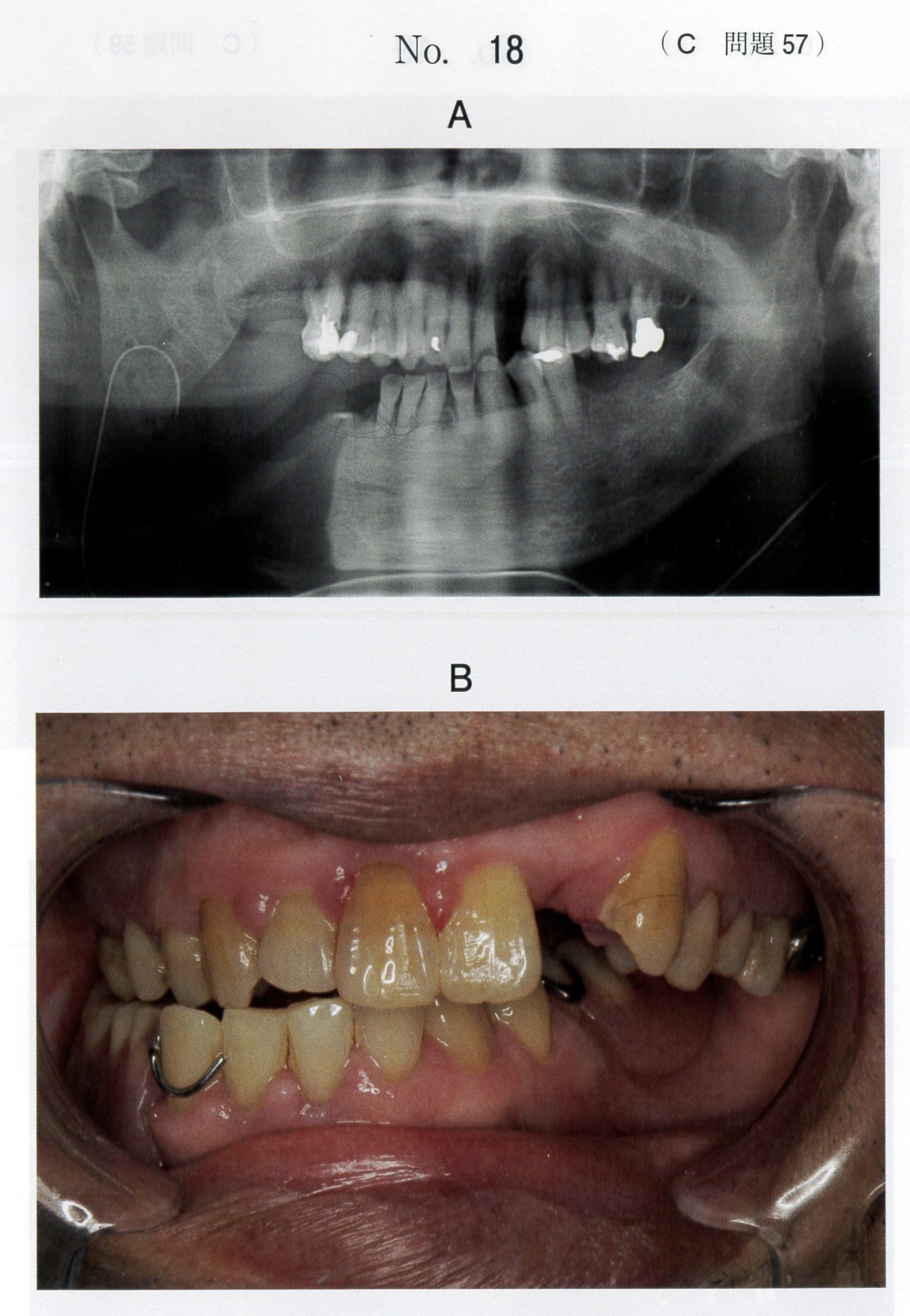 第119回 歯科医師国家試験 C問題 （2026年2月6日更新） | DENTAL YOUTH