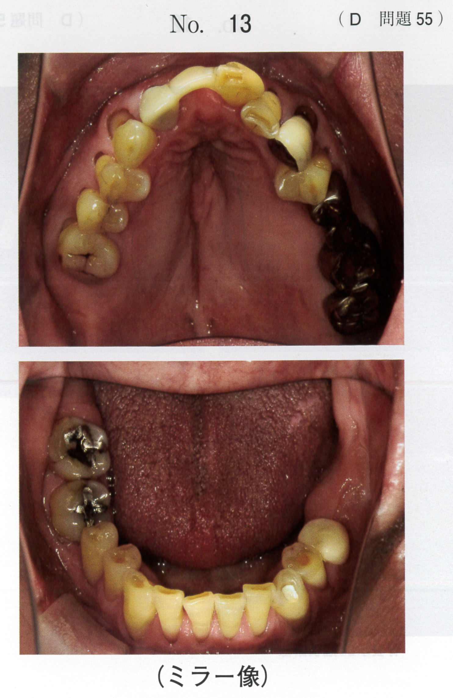 第119回 歯科医師国家試験 D問題 （2026年2月6日更新） | DENTAL YOUTH
