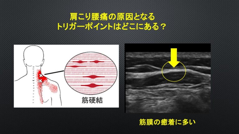 adceff4be04d70bd87867a275b4334