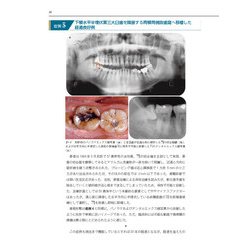 ヨドバシ.com - インプラント時代に見直す 歯の自家移植を始めよう