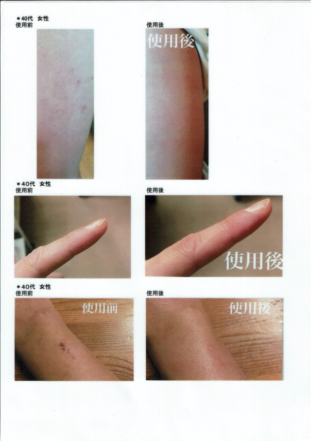 PharmaS1（皮膚トラブルに最適なシコニンクリーム【はな薬局オンライン