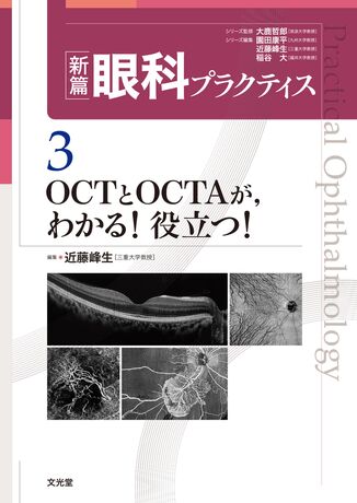 眼科プラクティス 3 OCTとOCTAが，わかる！役立つ！ | 神陵文庫