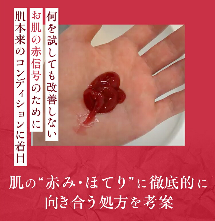 楽天市場】アトピロン オールインワンレッド アトピロンレッド ATPLON