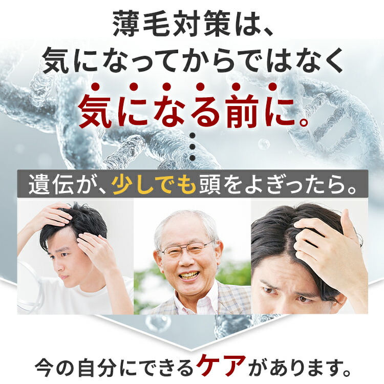 楽天市場】【第1類医薬品】 フォルテカ (72mL) ハイクラス 発毛薬 男性