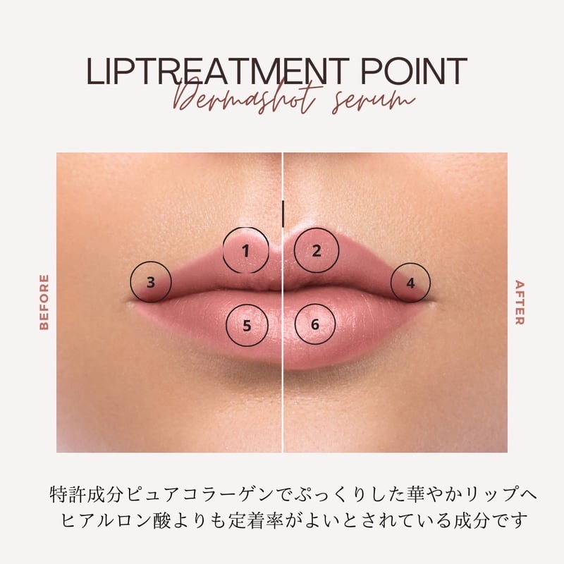 ダーマショットセラム 【正規取扱店】 | 【即日発送！】ダーマショット