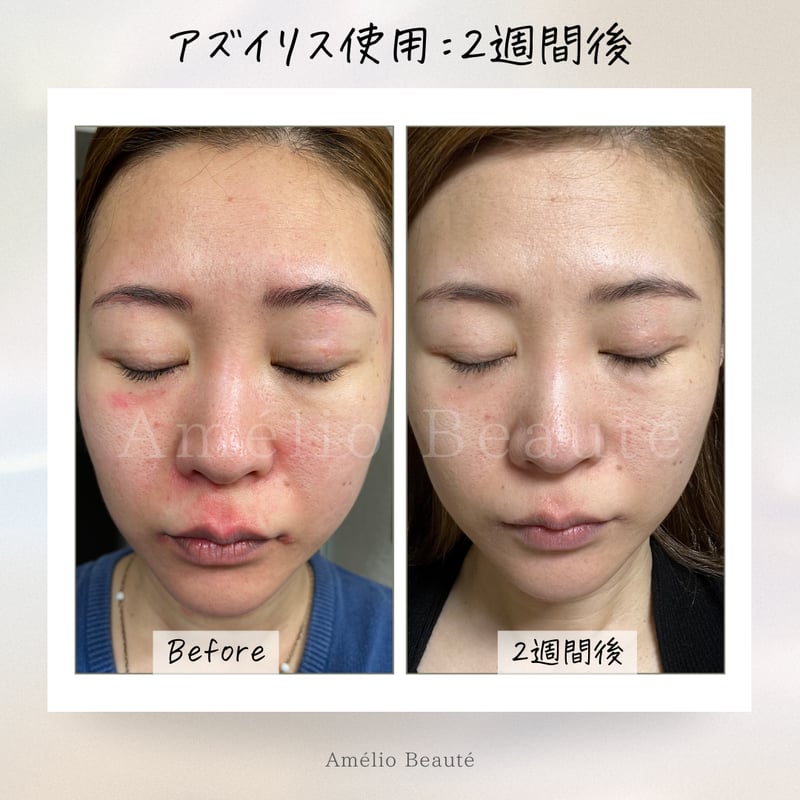 送料無料✨️最強3点セット‼️アズイリス(As_iris)＋アズルクス＋