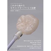 オーバーレイ修復 超入門 | 辻本真規 |本 | 通販 | Amazon
