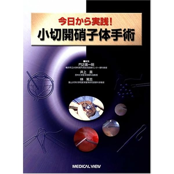 小切開硝子体手術 入門!−これだけわかれば始められる | 米田 一仁 |本