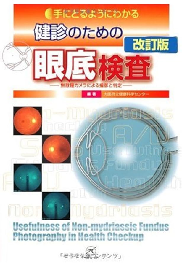 カラーアトラス眼底図譜 | 湯澤美都子, 川村昭之, 森隆三郎 |本 | 通販