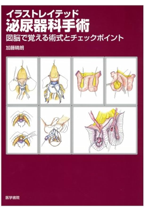 Amazon.co.jp: イラストレイテッド泌尿器科手術 (第2集) : 加藤 晴朗: 本