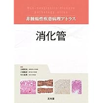 肺 (非腫瘍性疾患病理アトラス) | 蛇澤 晶, 熊坂利夫 |本 | 通販 | Amazon