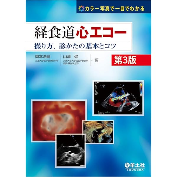 初心者から研修医のための経食道心エコ-: 部長も科長もみんな初心者