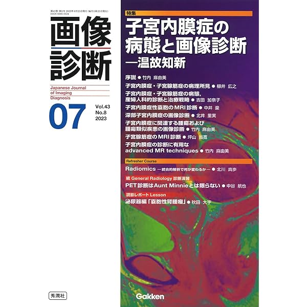 Amazon.co.jp: 画像診断 Vol.42 No.7(2022 6) : 画像診断実行編集委員