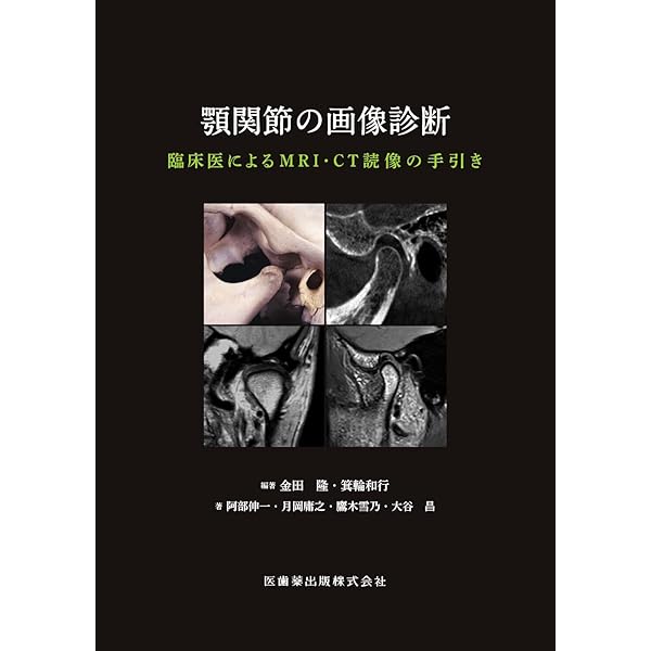 歯科臨床における画像診断アトラス 第2版 | 日本歯科放射線学会 |本