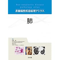 腎 (非腫瘍性疾患病理アトラス) | 大橋健一, 小池淳樹, 冨田茂樹, 原