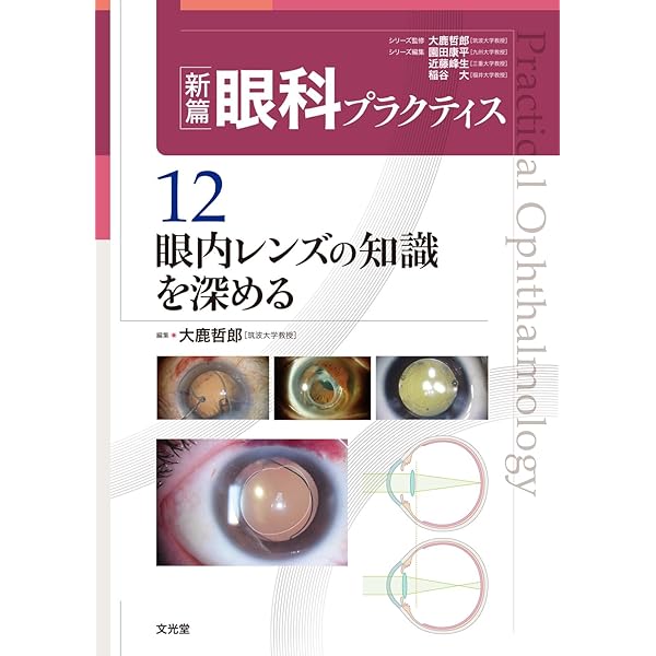 Amazon.co.jp: 眼科薬物療法リファレンス (新篇眼科プラクティス) (新
