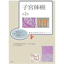 71CLh12US9L._AC_UL210_SR210,