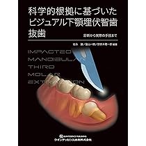 科学的根拠に基づいた ビジュアル下顎埋伏智歯抜歯 | 岩永 譲, 畠山