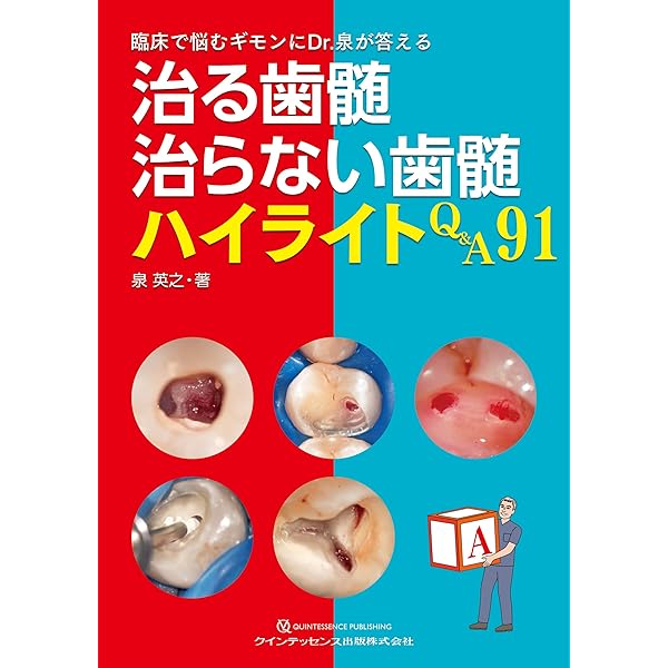 Amazon.co.jp: 深在性う蝕に対するVital Pulp Therapy: 歯髄保存か抜髄