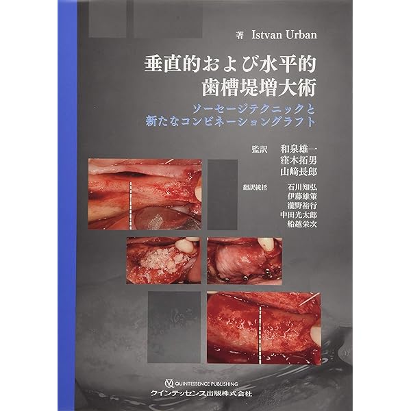 Vertical 2 骨造成: 垂直的および水平的歯槽堤増大術の完成形 | Istvan