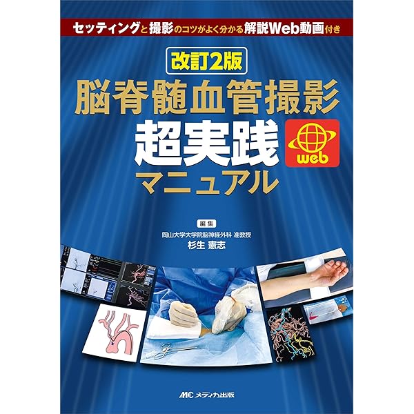 脳血管内治療 スタート&スタンダード | 吉村 紳一 |本 | 通販 | Amazon
