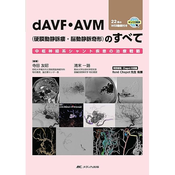 脳と頭蓋底の血管系アトラス 臨床解剖のバリエーション | 寳金清博
