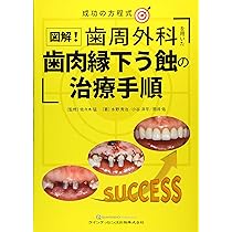 コンセプトをもった予知性の高い歯周外科処置 改訂第2版 | 小野 善弘